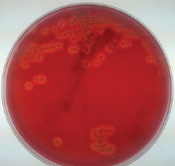 MRSA on a blood agar plate