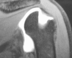 MRI scan of patient