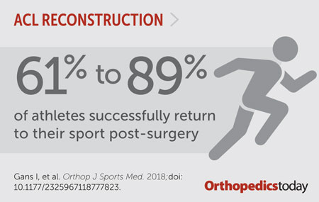 ACL reconstruction graphic