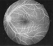 Fluorescein image