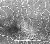 Fluorescein image