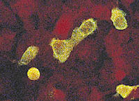 adenovirus