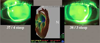 Reverse Geo Plateau Lens