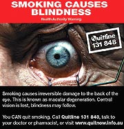 Smoking causes blindness: