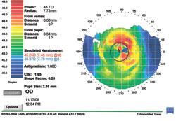 Figure 1a. Axial map