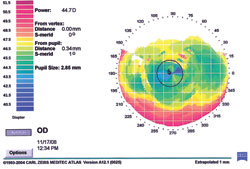 Figure 1c. Refractive map