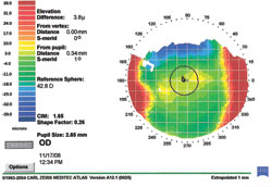 Figure 1e. Elevation map