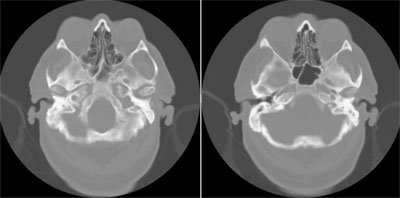 Figure 3. The imagery from the head CT performed earlier was available after the exam was completed. 