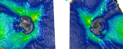 The patient's OCT showed inferior temporal green grassland with superior temporal blue river in the right eye and loss of green grassland with large superior temporal blue to light gray river and less developed inferior temporal blue river in the left eye. There appears to be an inferior temporal disc margin notch in the left eye.