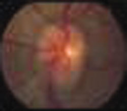 Magnified view of the left eye.