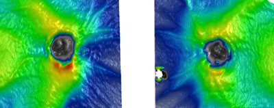 Note that the optic discs have a nasal tilt, with the nasal disc margin being truncated. The RNFL are in good condition with plenty of green color. The small area of no information is due to a floater in the left eye.