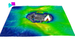 An optic pit is seen as an area of no information because the instrument cannot find the ILM or RPE layers. The RNFL is indicated to be in good condition by showing a lot of green color.