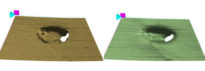 An optic pit is seen as an area of no information because the instrument cannot find the ILM or RPE layers. 