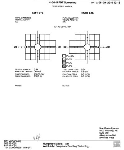 Humphrey Matrix (Carl Zeiss Meditec) visual fields show no defects in either eye.