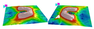 Note the elevated optic nerve heads. The small area of no information is due to a floater in the left eye.