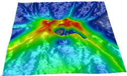 Note that the temporal disc margin has an elevated wall, which is fairly unusual in occurrence. This view is from temporal to nasal (front to back).