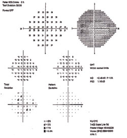 The right eye (top) showed an enlarged blind spot; the left eye appeared normal.