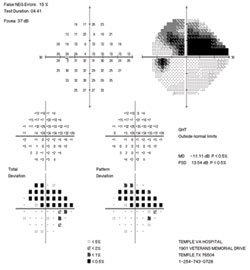 Follow-up visual field exam results appeared stable.