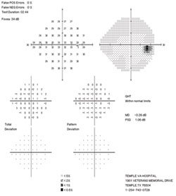 Follow-up visual field exam results appeared stable.