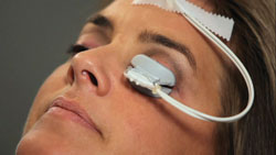 This patient with meibomian gland dysfunction is being treated with the TearScience LipiFlow system. 