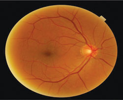 Central posterior pole of the right eye.