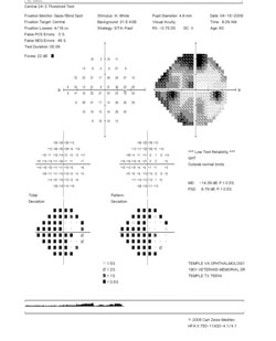 Visual field results. 