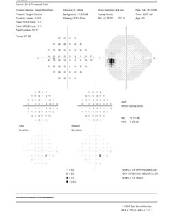 Visual field results. 