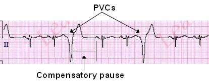 PVC Example