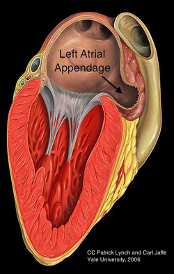 left atrial appendage