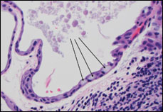 Magnified view of circled portion from previous figure. The arrows show characteristic goblet cells.