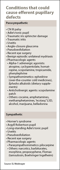 Conditions that could cause efferent pupillary defects