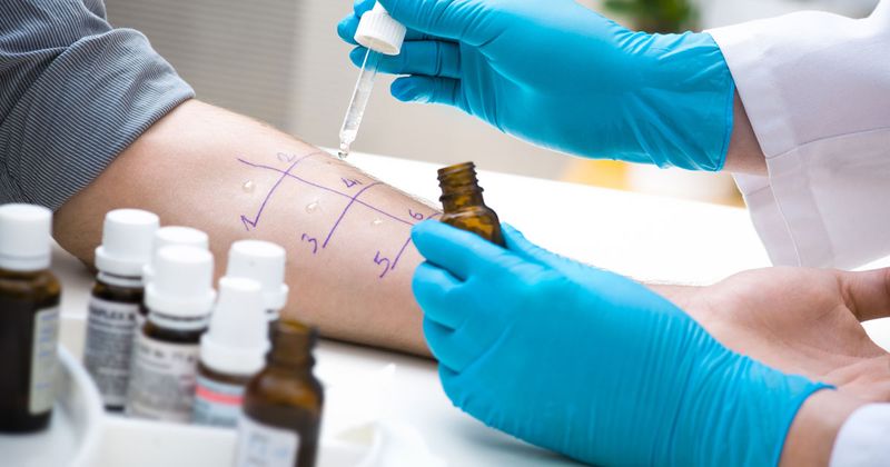 A skin prick test is done on a person's arm.