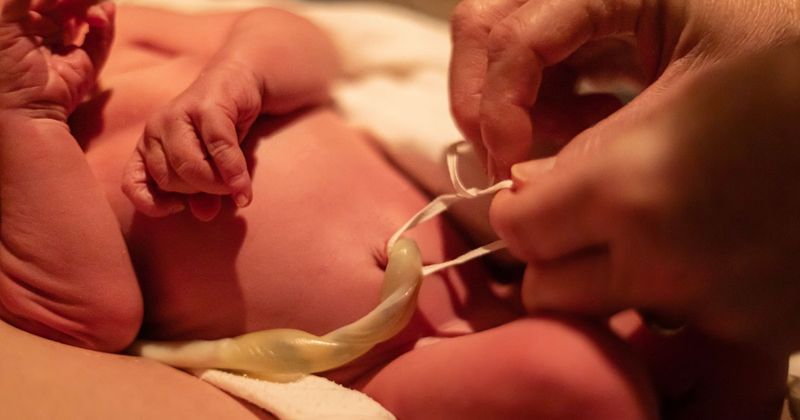 newborn baby with umbilical cord