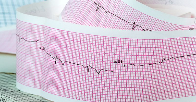 ECG reading