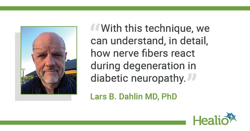 Lars B. Dahlin, MD, PhD