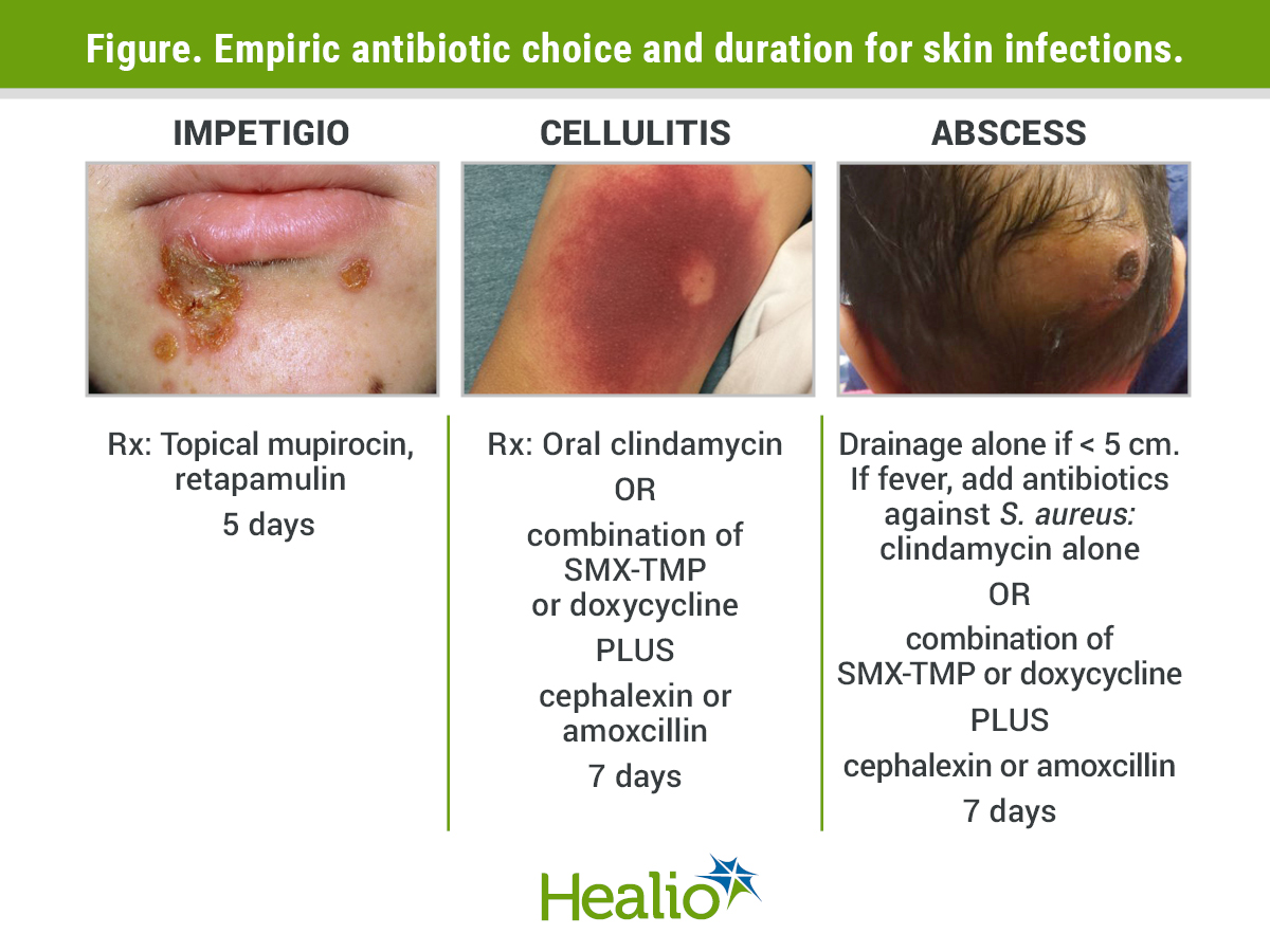 Antibiotics for skin infections