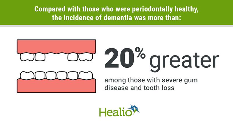 Dementia incidence in patients with severe gum disease, tooth loss