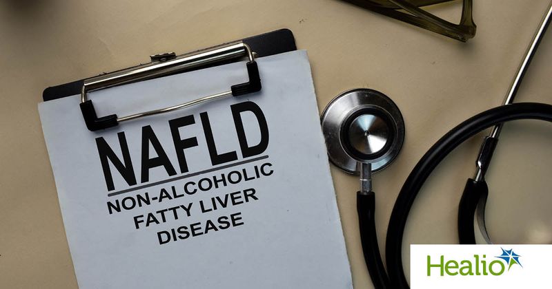 Non-alcoholic fatty liver disease