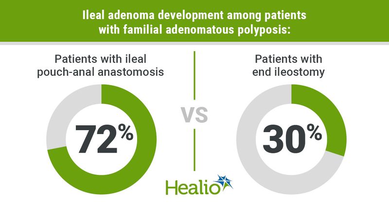  Ileal adenoma development among patients with familial adenomatous polyposis: Side A - Patients with ileal pouch-anal anastomosis; 72% Side B - Patients with end ileostomy;  30%