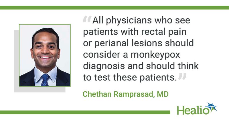 “All physicians who see patients with rectal pain or perianal lesions should consider a monkeypox diagnosis and should think to test these patients.” Chethan Ramprasad, MD