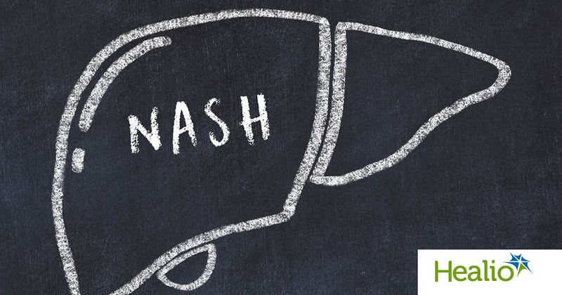 Chalk drawing of a liver with "NASH" written inside.