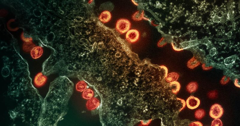 HIV virus particles NIAID