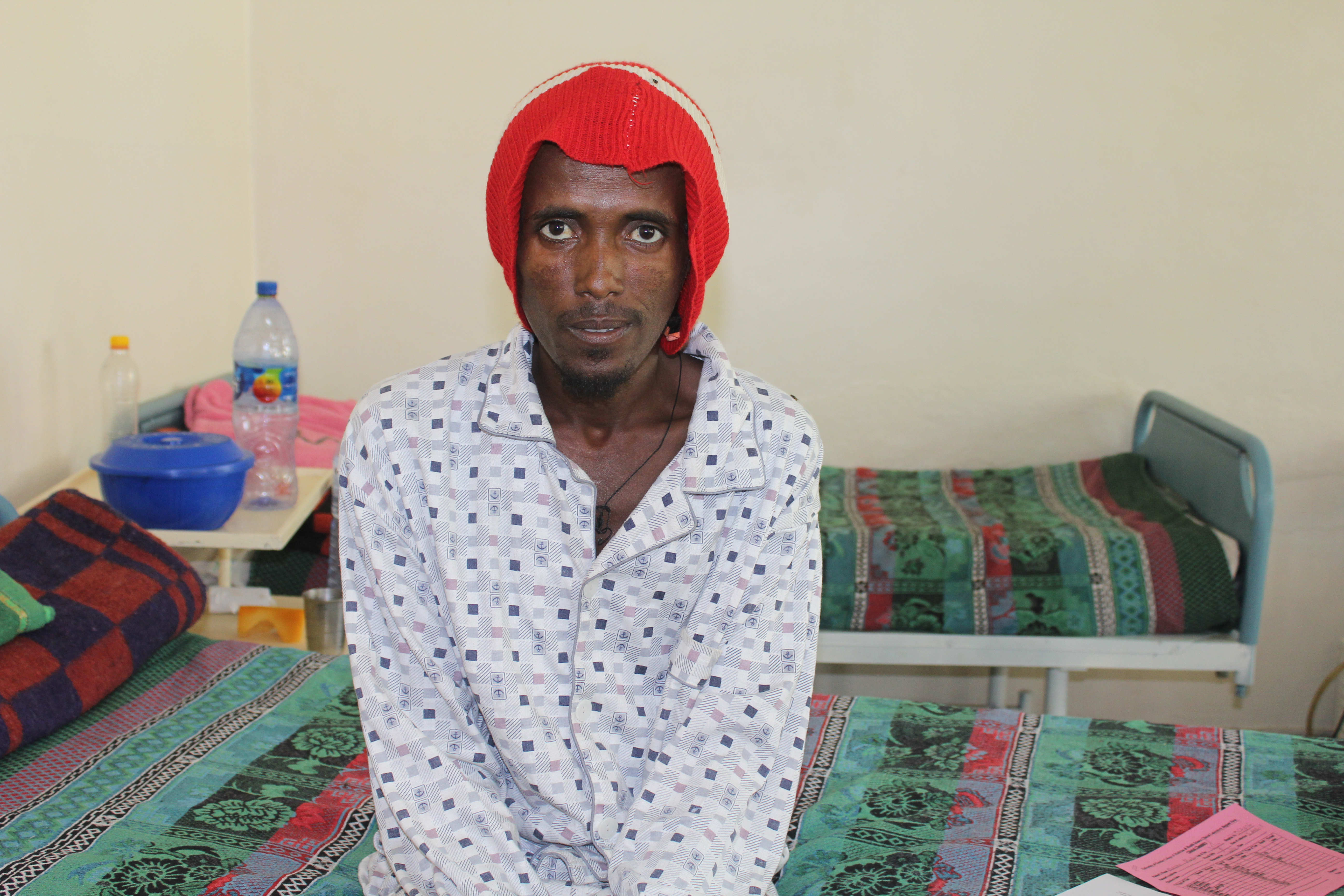 An HIV/visceral leishmaniasis patient at a research and treatment center in Ethiopia. 