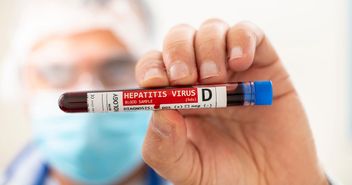 People with HBV, HIV coinfection at risk for hepatitis D &lsquo;superinfection&rsquo;