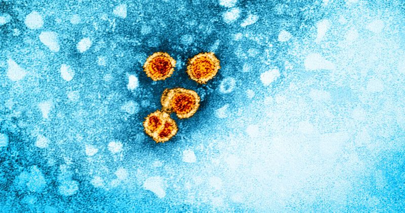 Hepatitis B virus particles NIAID