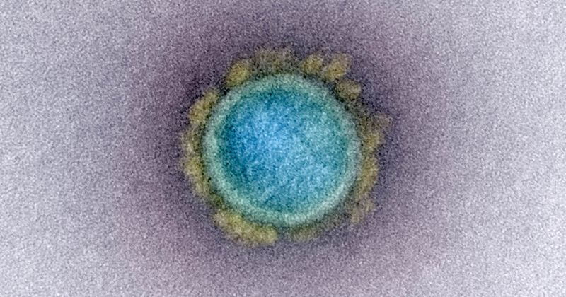 SARSCoV2_virus NIAID_WEB