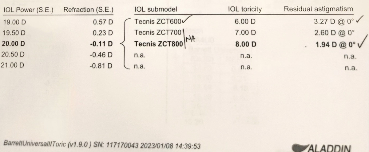 Jared Younger, MD, figure 2: Significant residual astigmatism in the right eye from the ZCT600 lens