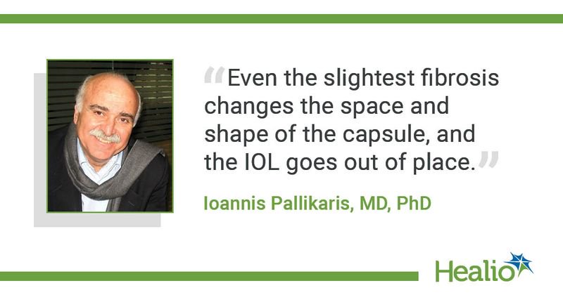 "Even the slightest fibrosis changes the space and shape of the capsule, and the IOL goes out of place.” Ioannis Pallikaris, MD, PhD