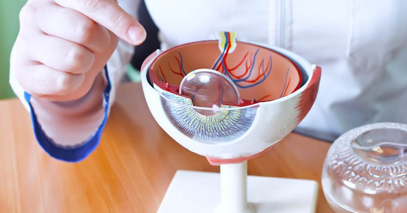 Cataract Surgery eye model