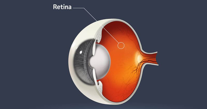 Retina